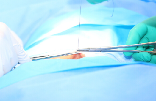 縫針疤痕為什麼會凸起？應該怎樣防治？