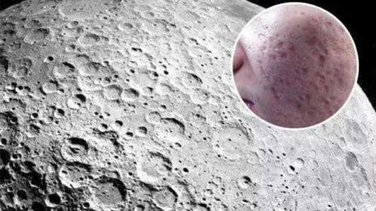 常見的治療青春痘疤痕的方法？